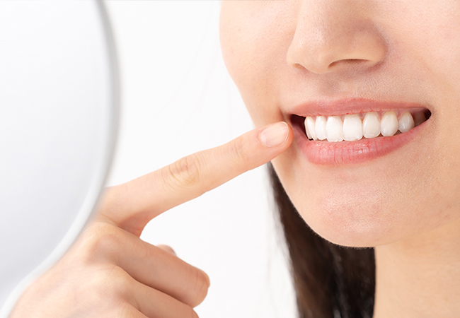 セラミック治療