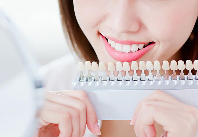 ホワイトニング